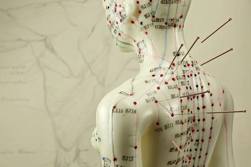 Acupuncture
